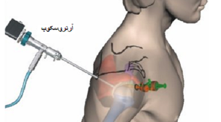 اصلاح بنکارت